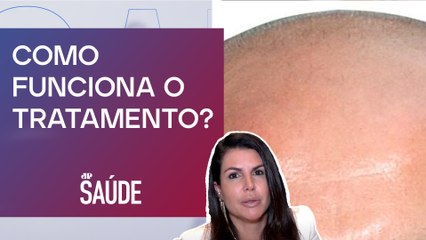 Para que servem as células de gordura para cabelo? | Dra. Ana Carina