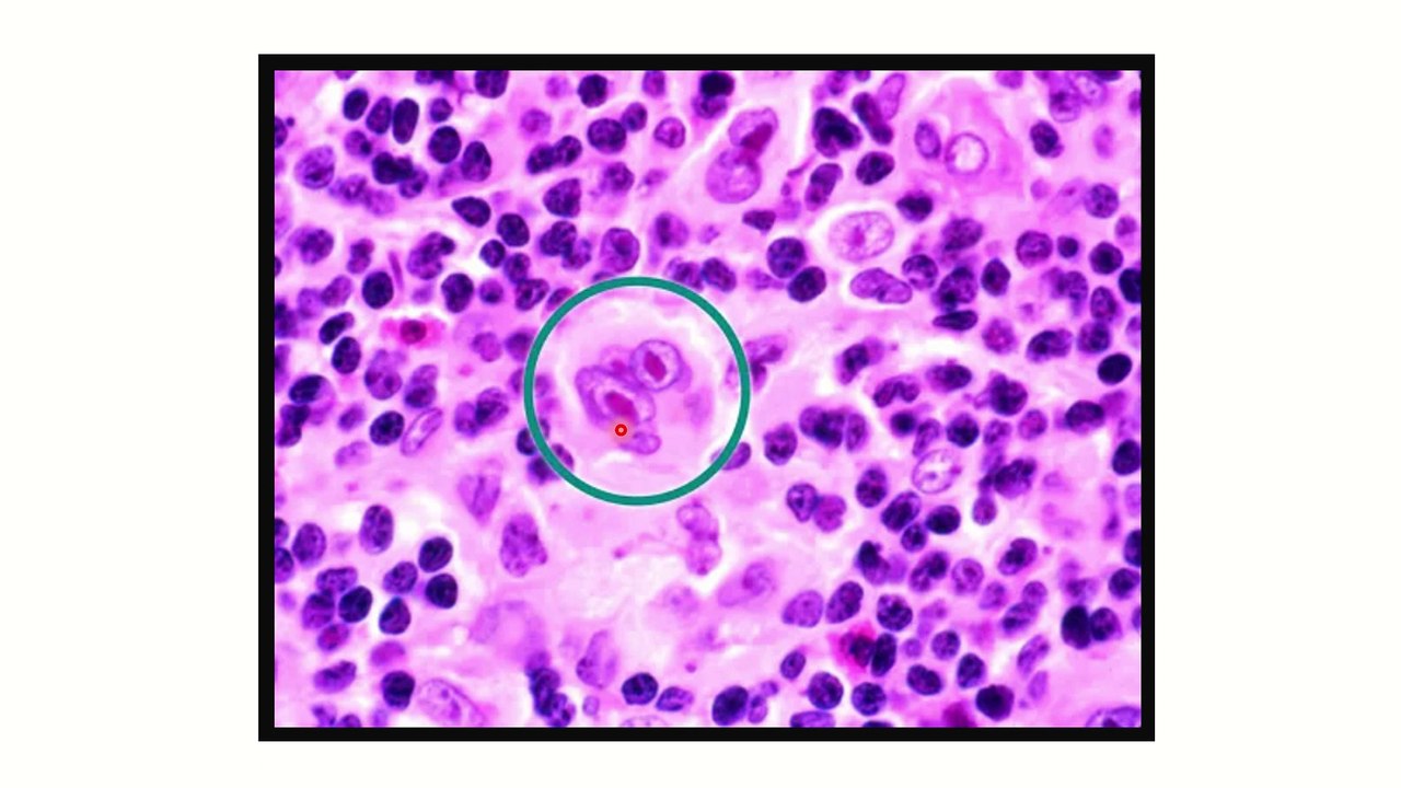 Recalls MRCS september 2023 MRCS