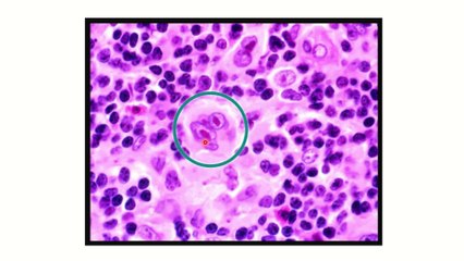 Recalls MRCS september 2023 MRCS