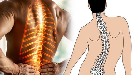Spinal Deformity In Hindi: स्पाइनल डिफॉर्मिटी क्या है, लक्षण और कारण | Symptoms & Causes |Boldsky
