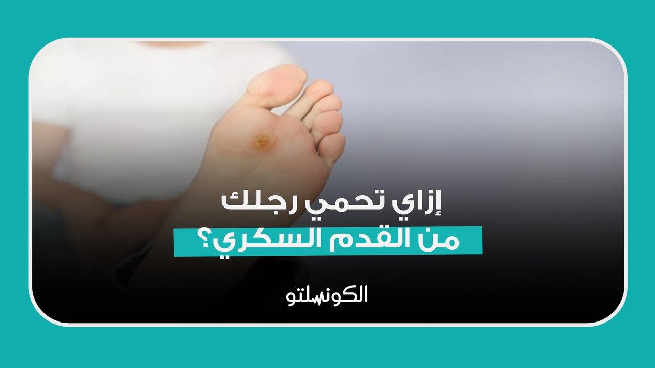 إزاي تحمي رجلك من القدم السكري؟