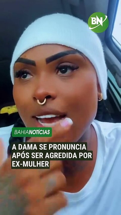 A Dama se pronuncia após ser agredida por ex-mulher: ‘Vou na delegacia’