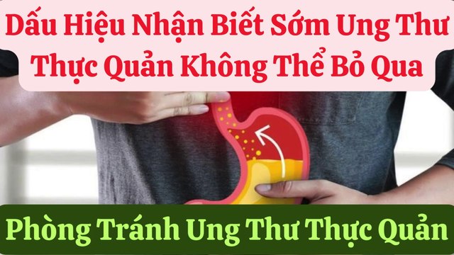 Dấu Hiệu Nhận Biết Sớm Ung Thư Thực Quản Không Thể Bỏ Qua, Phòng Tránh Ung Thư Thực Quản