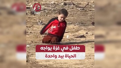طفل في غزة يواجه الحياة بيد واحدة
