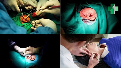 Tonsil Removal Surgery for Chronic Infections in Delhi