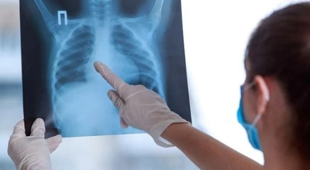 'Verem hastalığının teşhisi kolay, tedavisi de var'