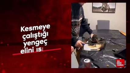 Kesmeye çalıştığı yengeç elini ısırdı