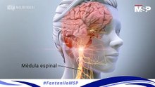 Fentanilo: Perspectivas Médicas en el Tratamiento del Dolor y la Crisis por Sobredosis