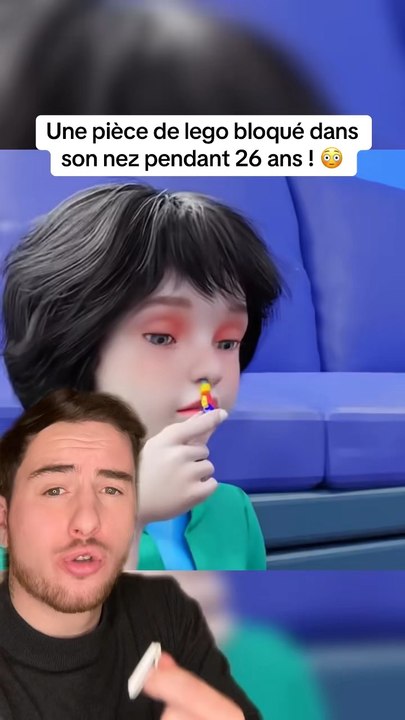 Du lego bloqué dans son nez pendant 26 ans