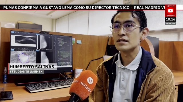 Investigadores del Edomex emplean algoritmos e IA para detectar cáncer de mama