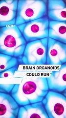 Brain organoids could run the AI of the future