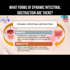 What forms of dynamic intestinal obstruction are there?