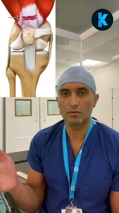 Mr. Bilal Barkatali's Treatment Options for Quadriceps Tendon Ruptures