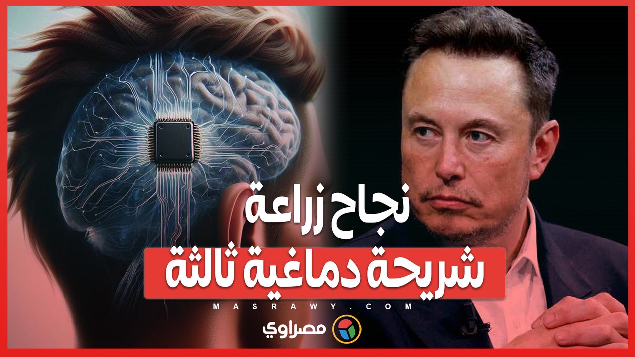 إيلون ماسك يواصل الابتكار ..  نجاح زراعة شريحة دماغية ثالثة من نيورالينك