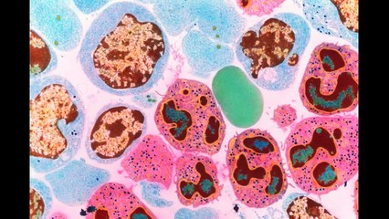 NASAs 5 hazards of human space flight - part 3