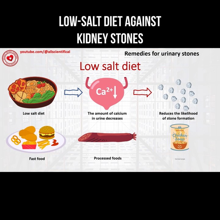 Low-salt diet against kidney stones