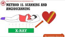 Scanning and angioscanning for heart examination