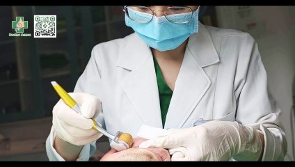 Lăn kim trị sẹo rỗ có hiệu quả không? Những điều cần lưu ý