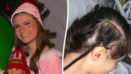 Singer has voice back after brain surgery to remove tumor making her 'tone deaf'