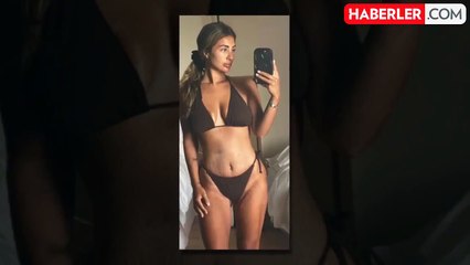 Kilo verme ameliyatı sonrası et parçaları kusan kadın, az daha ölüyordu