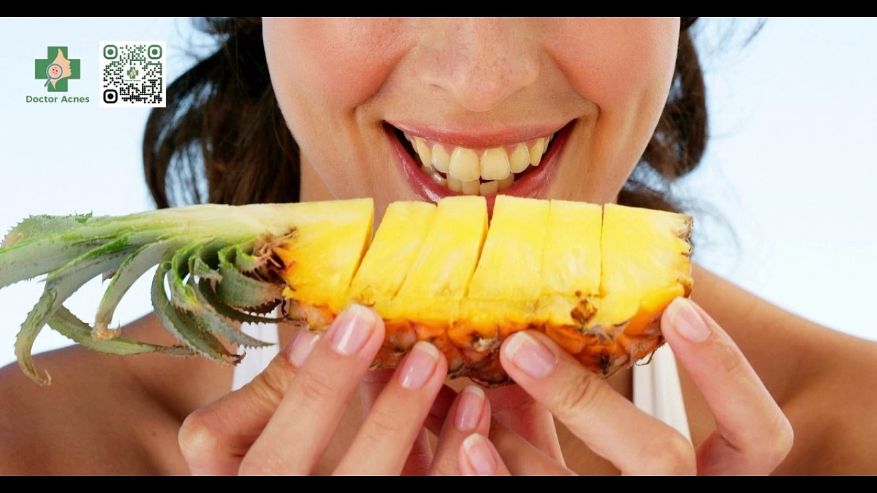 Ăn dứa có nổi mụn không? Lợi ích của dứa đối với làn da