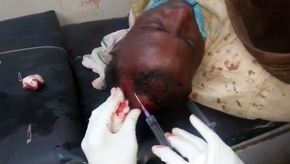 बहराइच - दो समुदायों में हुआ खूनी संघर्ष, जमकर चटकीं लाठियां और चले धारदार हथियार