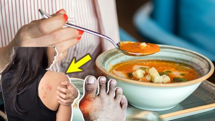 Tomato Soup Side Effects In Hindi: किन लोगों को टमाटर सूप नहीं पीना चाहिए, Stone & High Uric Acid