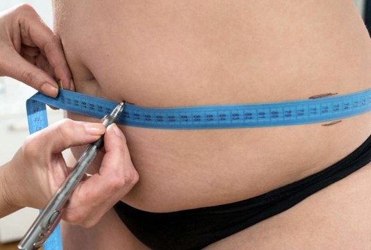 « Mommy Makeover » : quelle est cette chirurgie esthétique post-grossesse et quels sont les risques ?