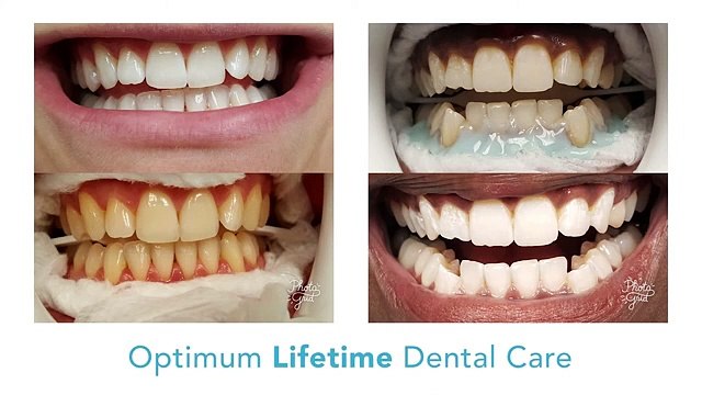 Experience Exceptional Dental Care at Town Square Dentistry