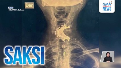 81-anyos na lalaki, nalunok ang kanyang pustiso sa gitna ng epileptic episode | Saksi