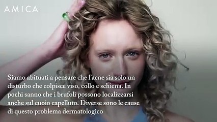 Brufoli in testa: tutte le cause e i rimedi