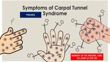 Signs of carpal tunnel syndrome