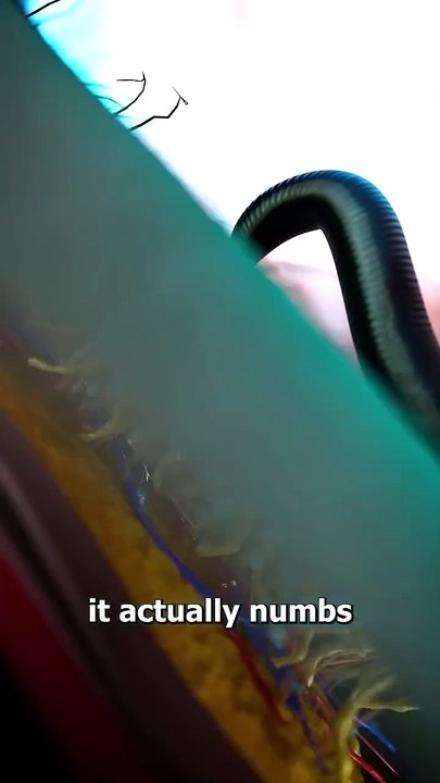 How Leeches Suck Your Blood 😟