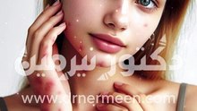 أعراض البهاق في الجسم #اعراض #عرض #مرض #بهاق #البهاق #امراض_جلدية #الجلد #النمش #حبوب #جلدية