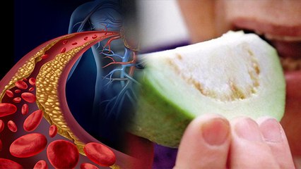हाई कोलेस्ट्रॉल में अमरूद खाने के फायदे, High Cholesterol Me Amrudh Khane Ke Fayde | Boldsky