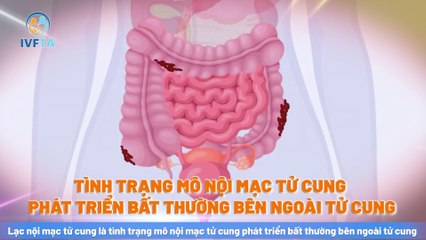 Lạc nội mạc tử cung là gì? Nguyên nhân, dấu hiệu và cách điều trị