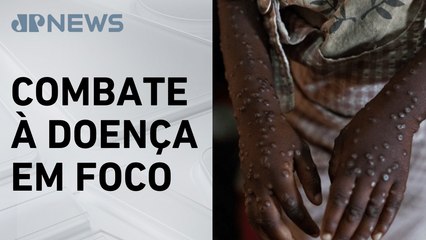 Ministério da Saúde vai comprar testes para estudar Mpox