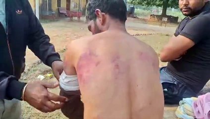 ईंट भट्ठे पर ट्रैक्टर चालक से बंधक बना मारपीट, पुलिस जांच में जुटी