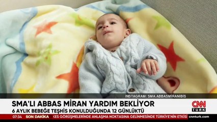 SMA'lı Abbas Miran yardım bekliyor
