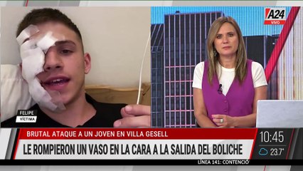 Nueva agresión en Villa Gesell: joven herido tras brutal ataque
