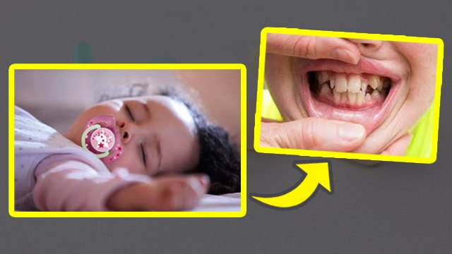 Baccho Ko Chusni Kab Deni Chahiye | Is Pacifier Bad For Babies, Side Effects...|Boldsky