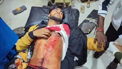 क्रिकेट खेल रहे छात्र को बदमाशों ने मारी गोली