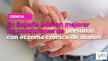 Afectados por eccema crónico de manos piden adaptar su puesto de trabajo