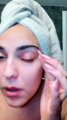 Το βίντεο της Βρισηίδας Ανδριώτου με το πρησμένο μάτι της