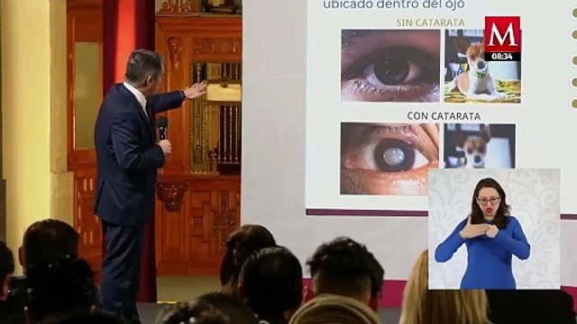SSA presenta 'Ver por México', cirugías gratuitas a personas con cataratas