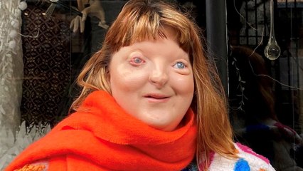 "I've embraced my disabilities and wear colourful outfits to stand out"