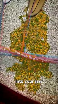 Cette simulation terrifiante qui montre comment une infection dentaire peut provoquer la mort donne des cauchemars aux internautes