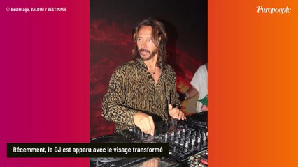 "Je m’attendais à la question" : Bob Sinclar explique enfin son visage transformé