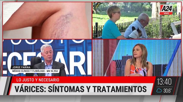 🔴 VARICES: SÍNTOMAS Y TRATAMIENTOS