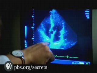 SECRETS OF THE DEAD | Doping for Gold | PBS